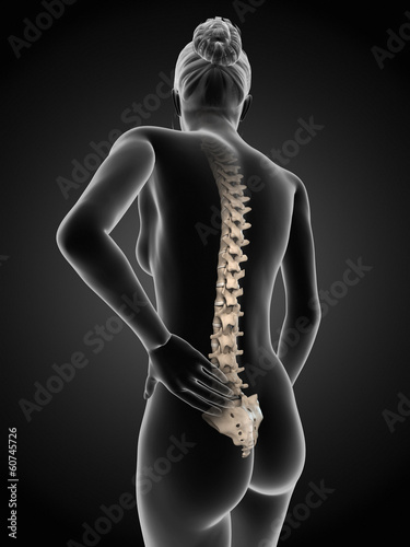 3d rendered medical illustration - Acute pain in a woman´s back. photo