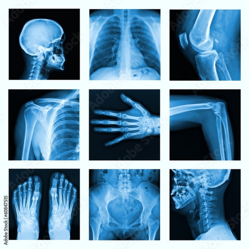 Collage of many X-rays in very good quality. photo