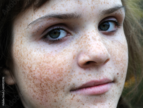 portrait of freckled teenage girl