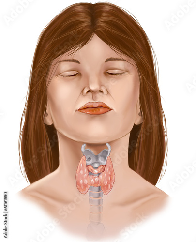 thyroid photo