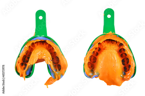 dental impression photo