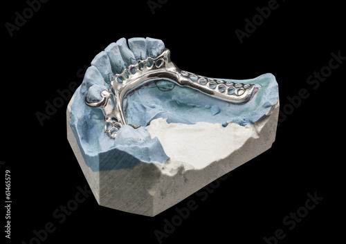 Fotografie Dental Prothetic laboratory,partial denture molds