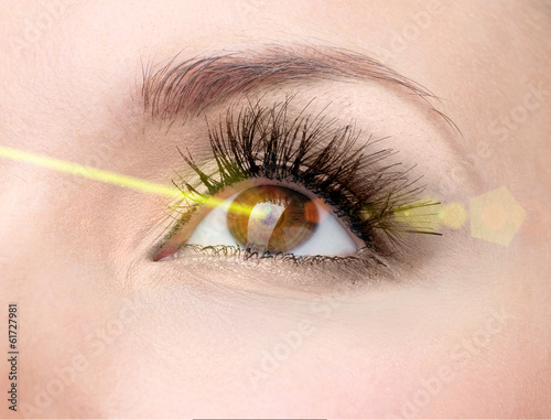 Laser vision correction. Woman's eye.