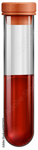 A test tube with a blood sample