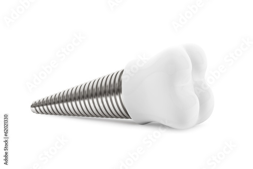 Fototapeta Naklejka Na Ścianę i Meble -  Dental concept. Tooth Implant