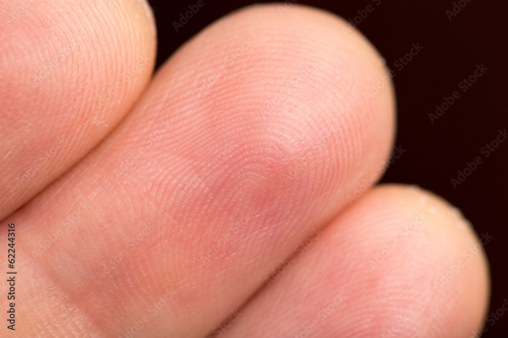 finger on a black background. macro finger on a black background. macro