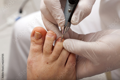 Nagelbehandlung bei einem Fußpfleger