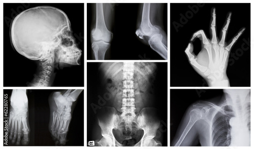 collection of x-ray