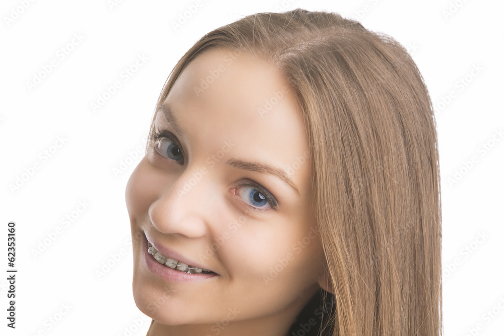Face Closeup of Smiling Young Caucasian Blond With Teeth Bracket Face Closeup of Smiling Young Caucasian Blond With Teeth Bracket