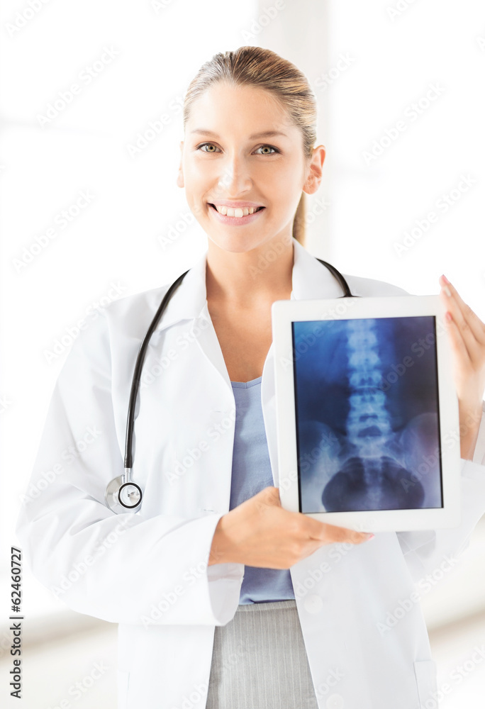 female doctor with x-ray on tablet pc female doctor with x-ray on tablet pc