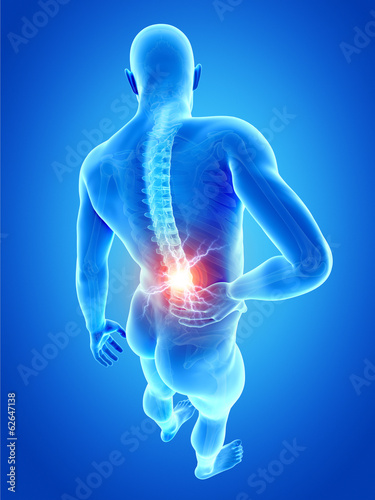 a man having acute pain in the back