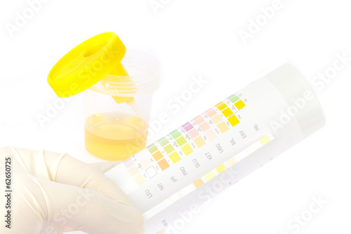 Urine sample with test strips