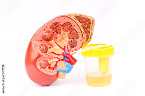 Kidney, urine sample and test strips