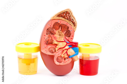 Kidney, normal urine and bloody urine