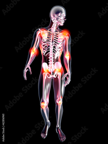 Anatomie - Gelenkschmerzen photo