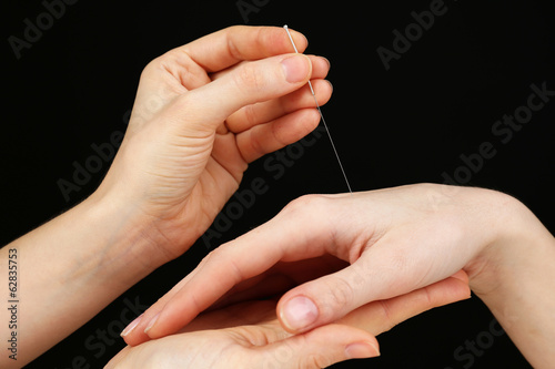 Acupuncture on hand  close up  on dark background