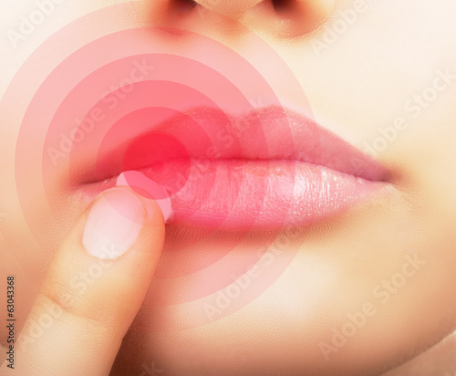 Woman applying cream on lips affected by herpes, shown red. #63043368
