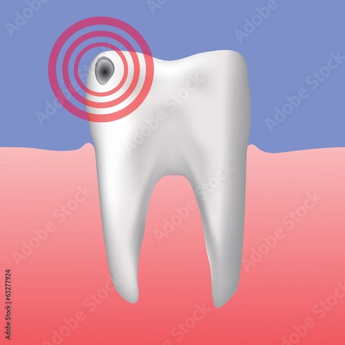 hole in the tooth