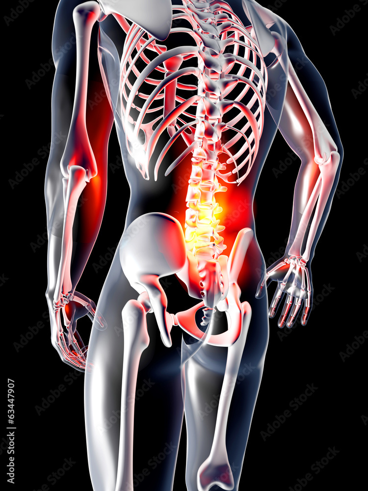 Anatomie - Rückenschmerz Stock Illustration | Adobe Stock