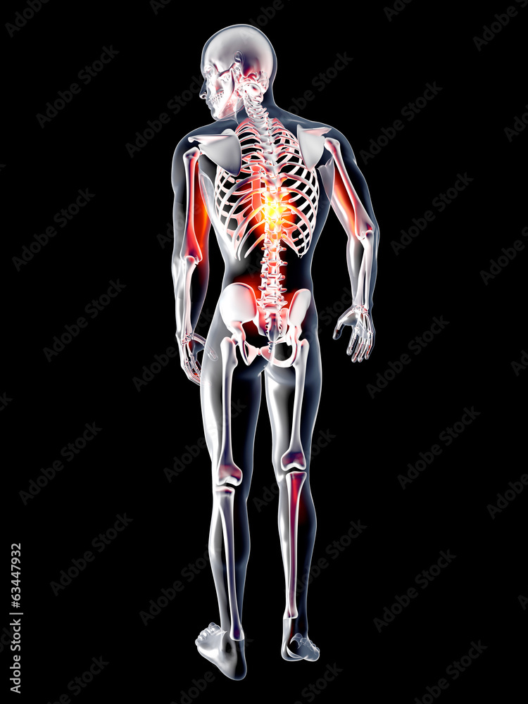 Anatomie - Rückenschmerz Anatomie - Rückenschmerz