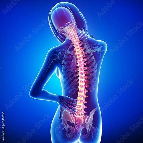 Female back pain anatomy