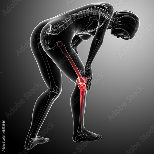 Anatomy of female knee pain on black photo