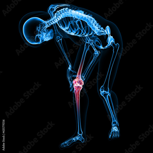 Human knee pain anatomy on black photo