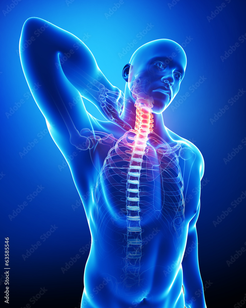 Anatomy of male neck pain blue Stock Illustration | Adobe Stock