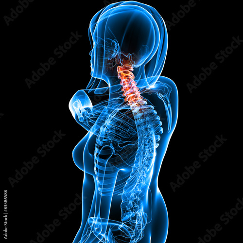 Anatomy of female neck pain in black