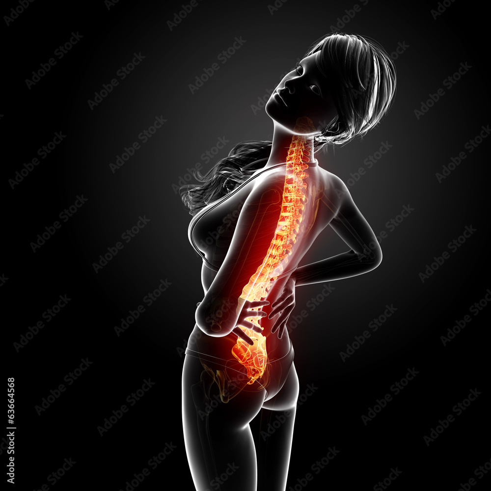 Female Back Problems Female Back Anatomy