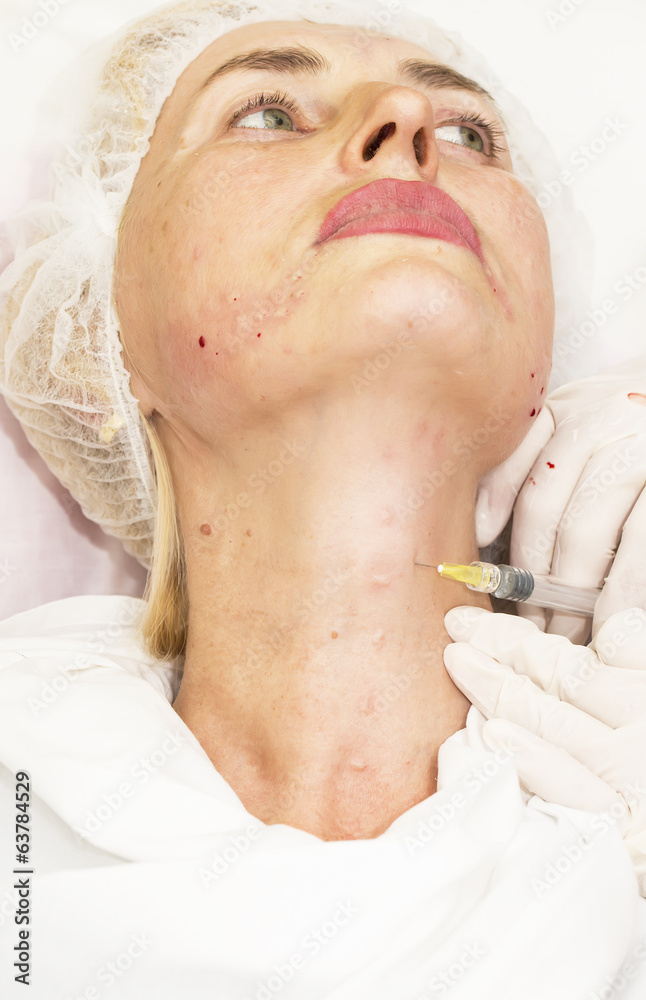 Cosmetic treatment with injection in a clinic Cosmetic treatment with injection in a clinic