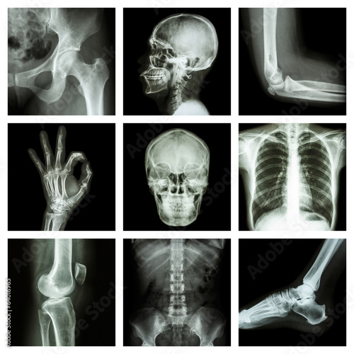 Collection of X-ray part of human