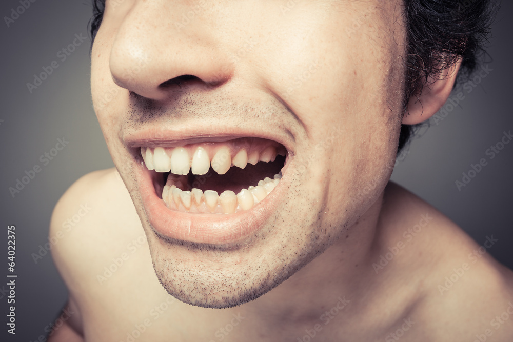 Fototapeta premium Young man with plaque on his teeth