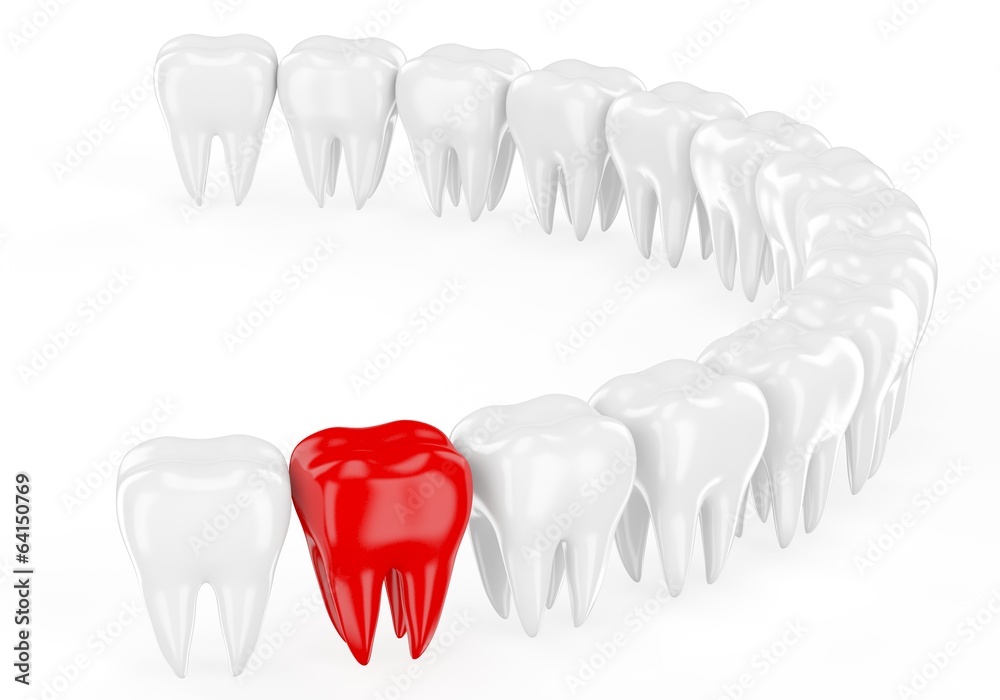 Aching tooth in row of healthy teeth. 3d Aching tooth in row of healthy teeth. 3d