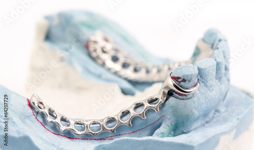 Dental wire bending