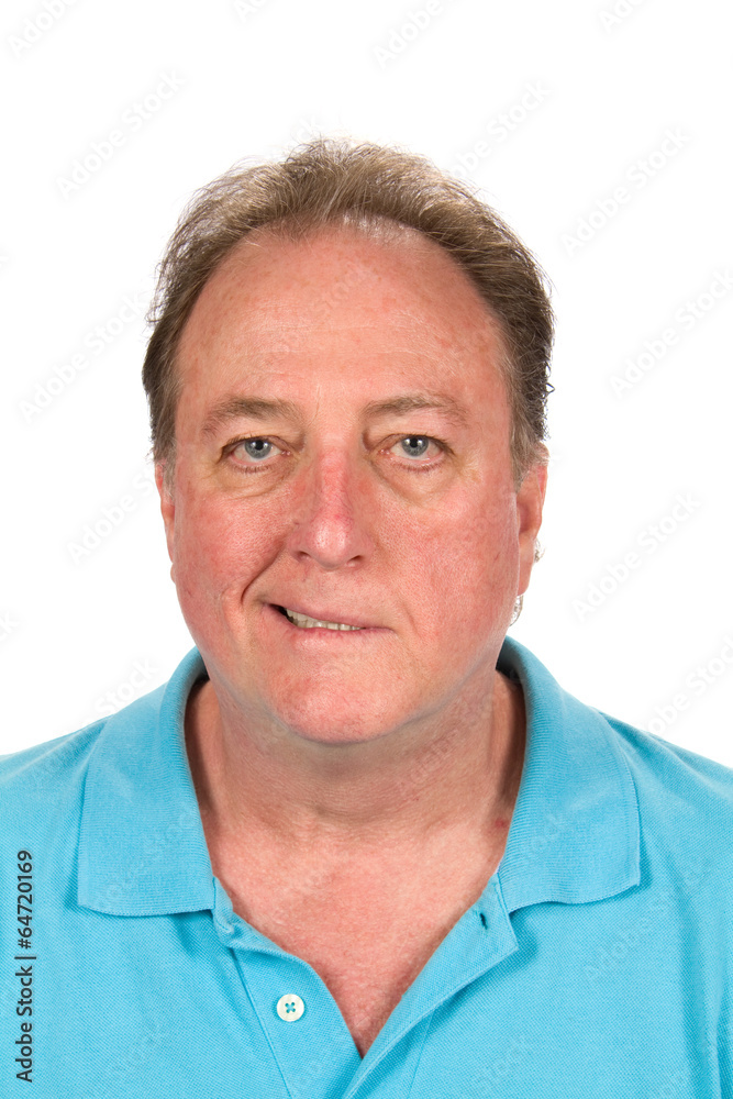 Mans Bell's Palsy Mans Bell's Palsy