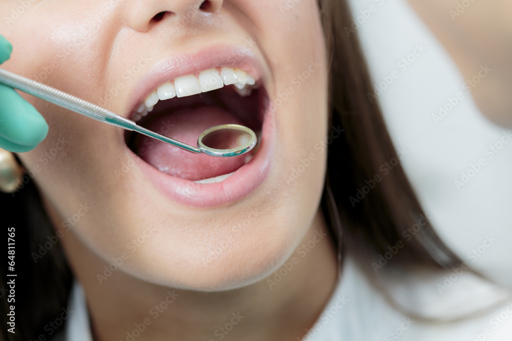 Young woman at the dentist Young woman at the dentist