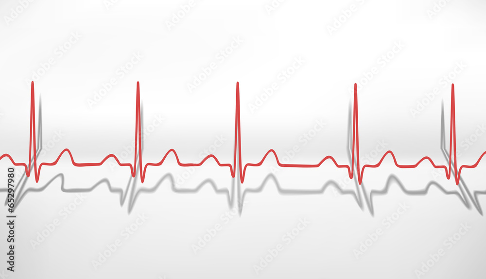 Heartbeat ECG