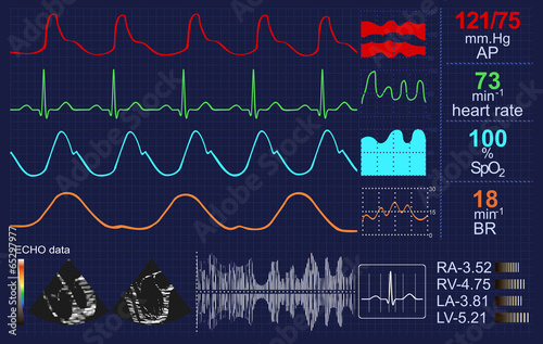 Heartbeat monitor with lots of curves and other data