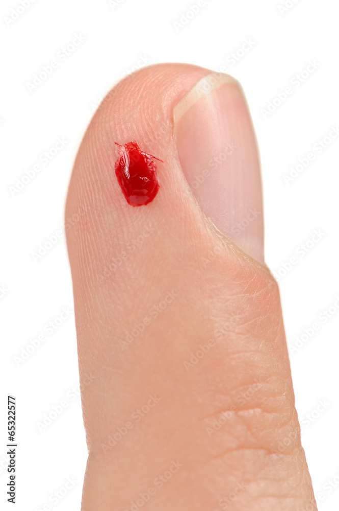 Blood on Cut Finger Blood on Cut Finger