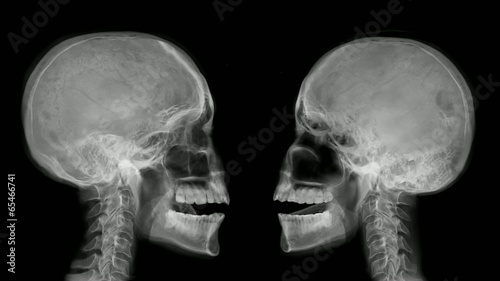 Two arguing skulls. photo