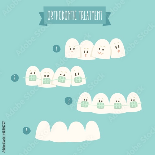orthodontic treatment (tooth braces) vector illustration
