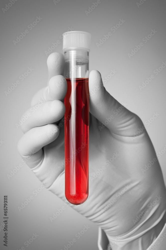 Doctor's hand with blood sample Doctor's hand with blood sample