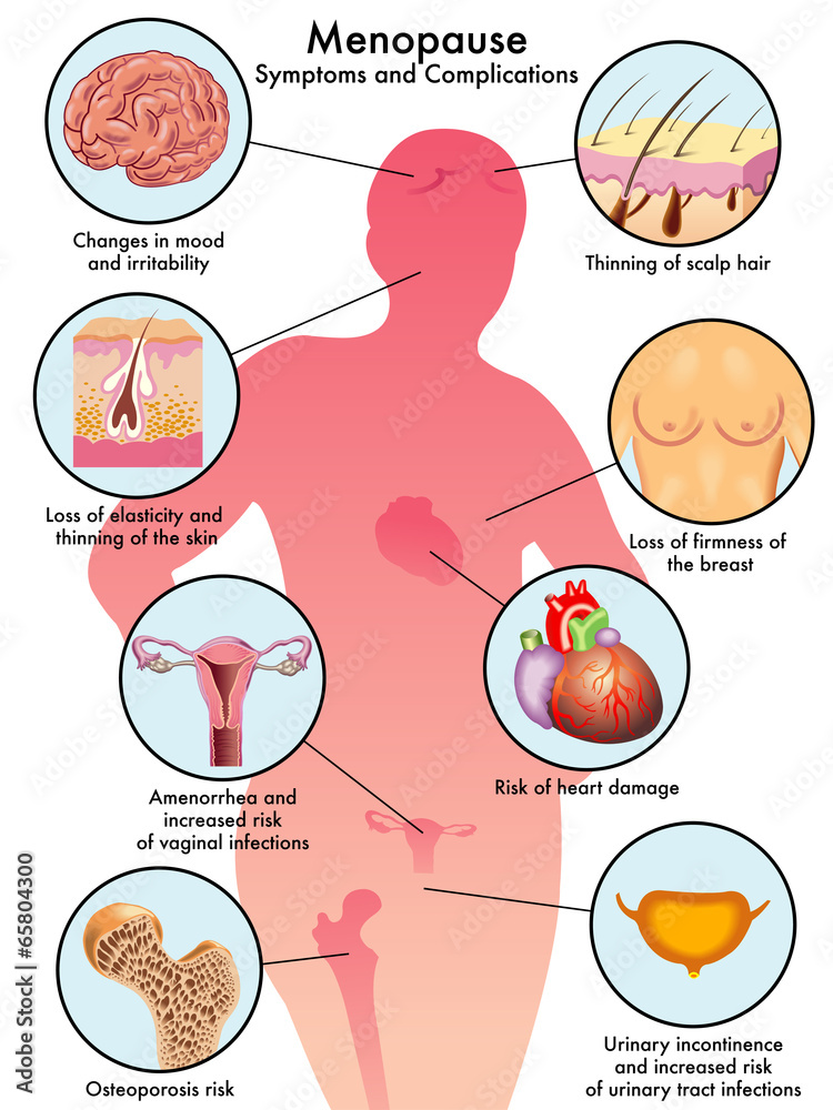 menopausa Adobe Stock