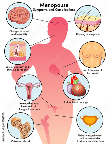 menopausa