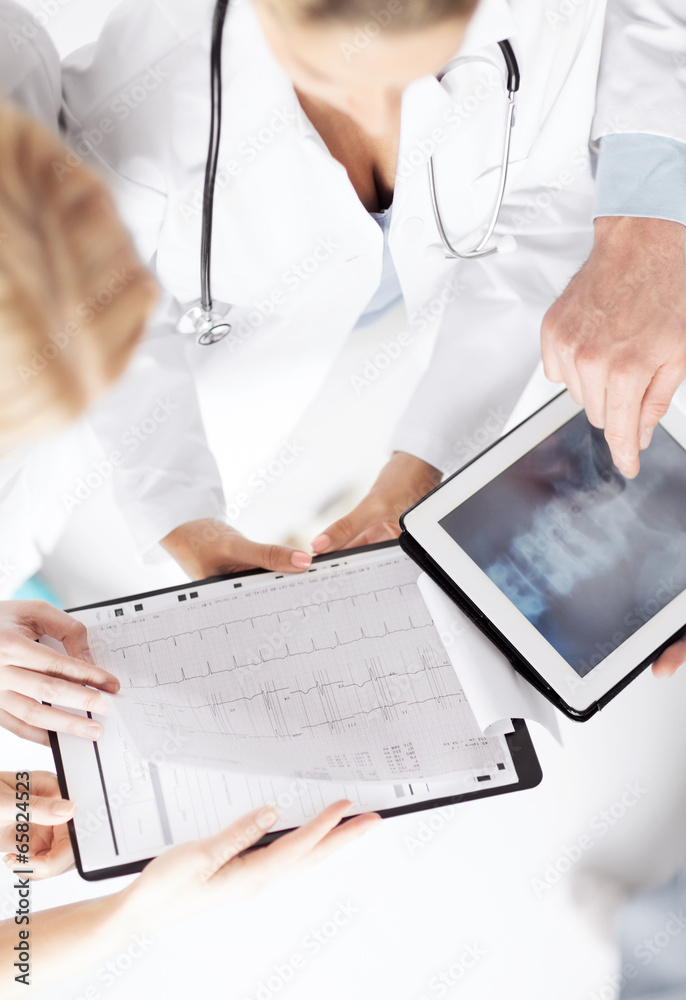 group of doctors looking at x-ray on tablet pc group of doctors looking at x-ray on tablet pc