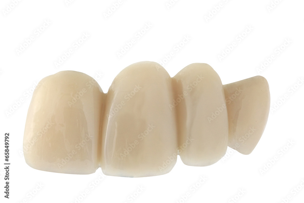 Obraz premium Bridge denture