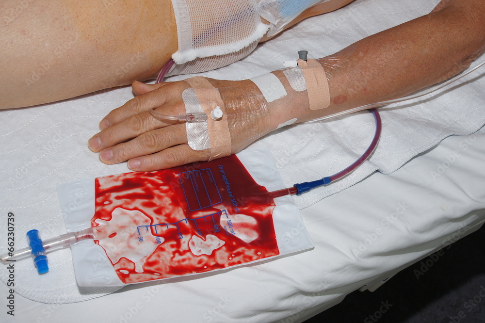 Bauch-Op Stock Photo | Adobe Stock