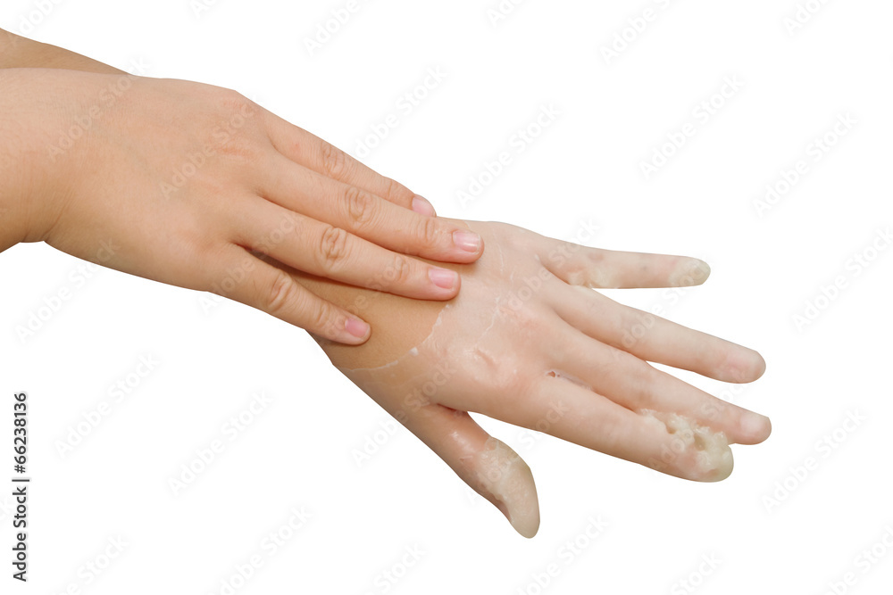 spa hand treatment and beauty,Hand in paraffin bath ,woman recei spa hand treatment and beauty,Hand in paraffin bath ,woman recei