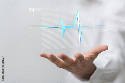 ecg
